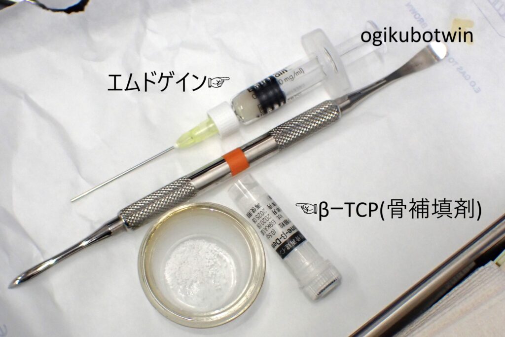 再生治療　エムドゲイン